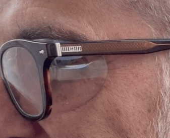 Lunettes à chambre humide LOptiques des Lions Optikid Yerres France Sécheresse Oculaire